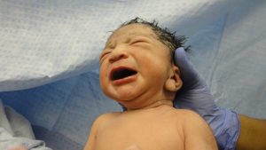 Neonato